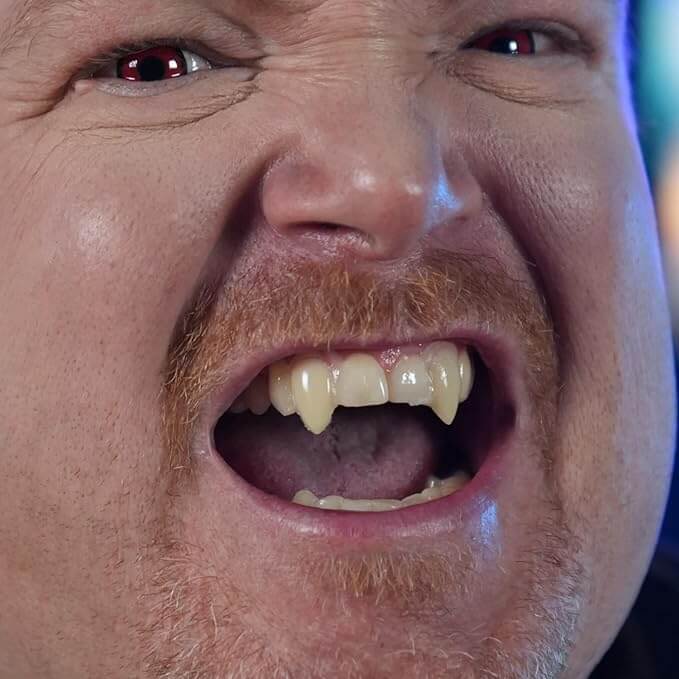 Small Custom Fit Vampire Fangs